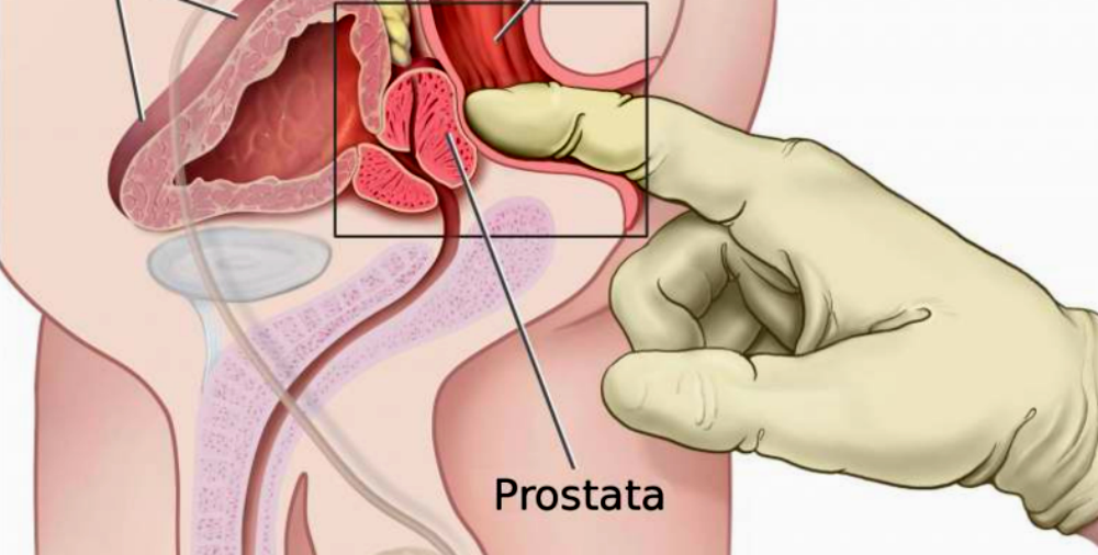 come stimolare la prostata uomo 2017