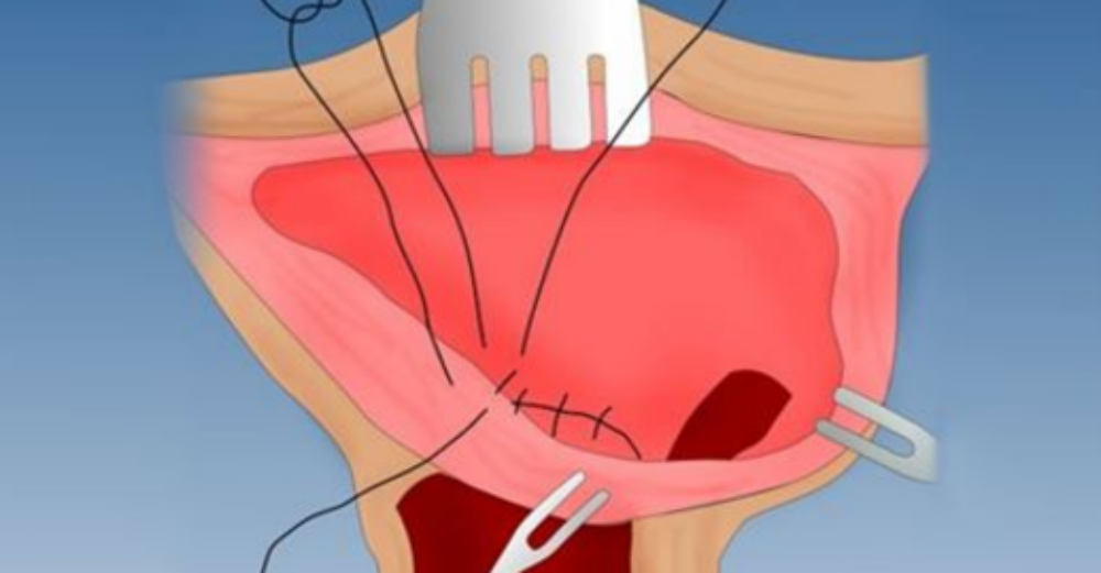 migliorare la circolazione al pene migliorare la circolazione al pene